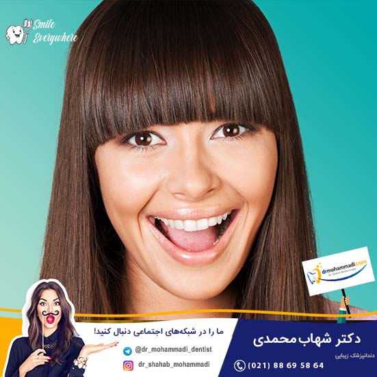 اسرار لمینت دندان بازیگران ایرانی فاش شد - کلینیک دندانپزشکی دکتر شهاب محمدی
